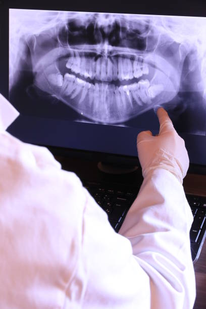 Best Dental Abscess Treatment in Montello, WI