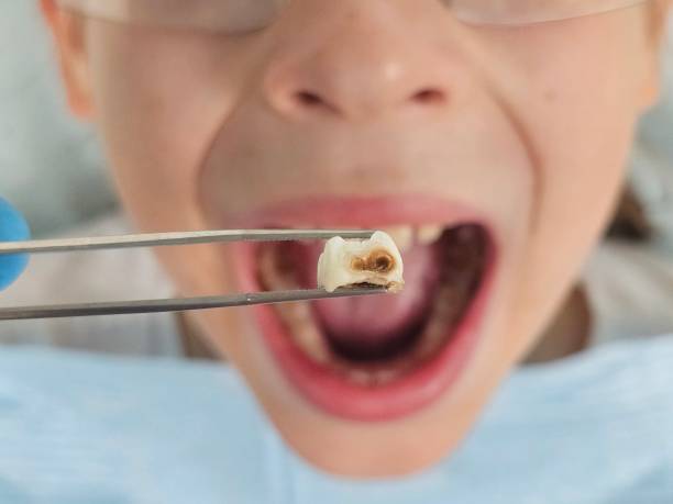 Best Urgent Dental Care for Toothaches in Montello, WI