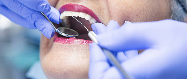 Best Emergency Dental Care for Sports Injuries in Montello, WI